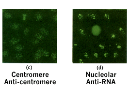 ana anti staining homogeneous cyberounds patterns figure
