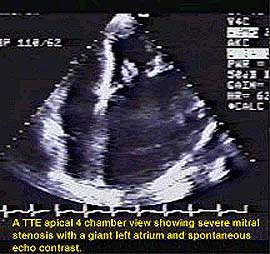 Figure 1A