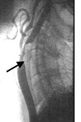 Figure 1A