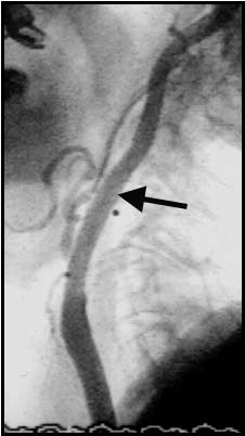 Figure 1B