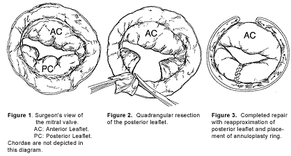 Figures 1-3