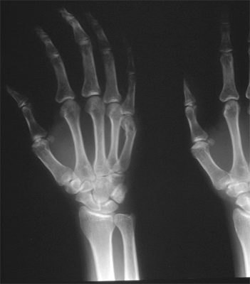 Figure 2B