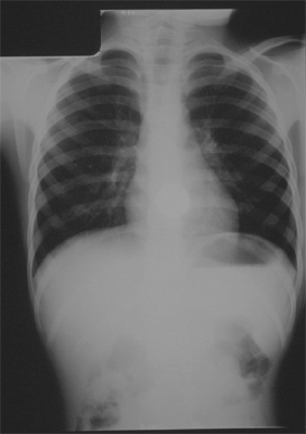 Figure 3B