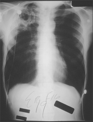 Figure 4B