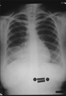 Figure 6B
