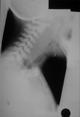 Figure 10B