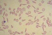 Figure 2B