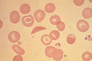 Figure 2C