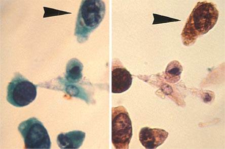 Figure 16