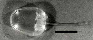 Figure 13A