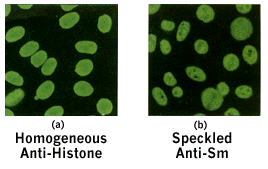Figure 1A