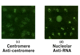 Two Clustering Diffusion Patterns Identified from the 2001вЂ“2003