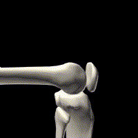 Figure 1A