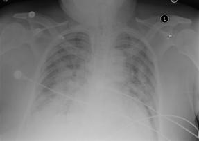 Figure 1A